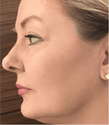 About Dualsonic Professional. Anti-aging, skincare and beauty.