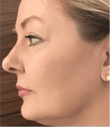 About Dualsonic Professional. Anti-aging, skincare and beauty.