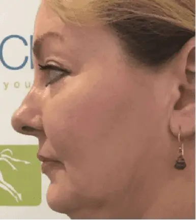 About Dualsonic Professional. Anti-aging, skincare and beauty.